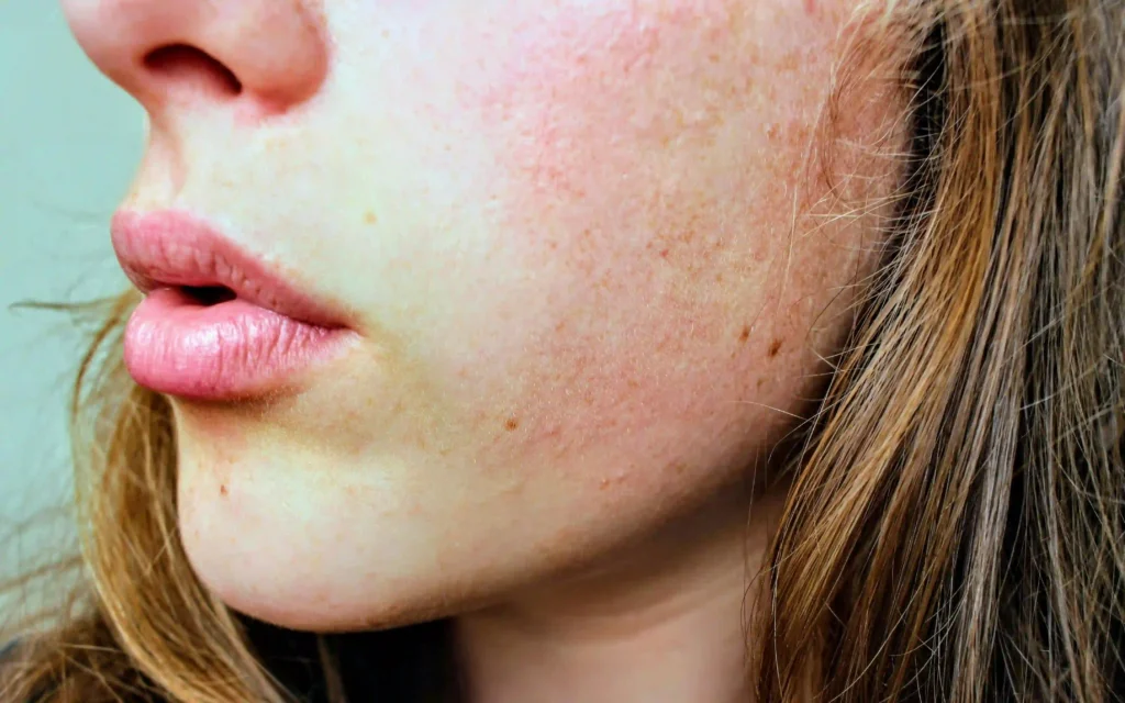 Improves Skin Health Image