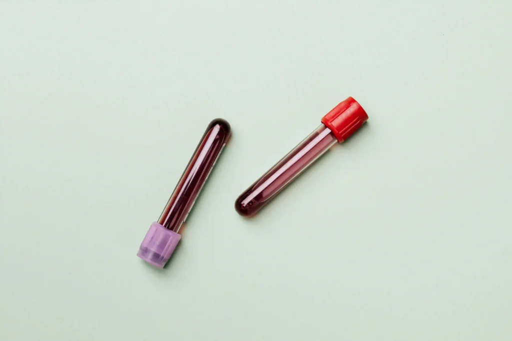 Blood test Image
