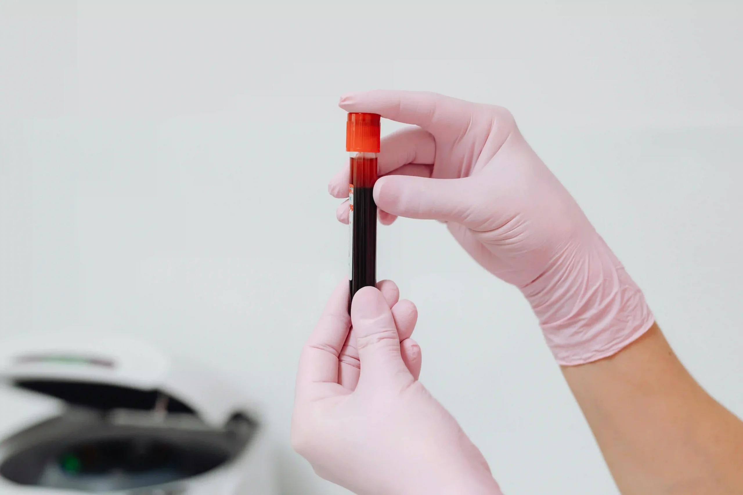 Can a Simple Blood Test Detect Cancer Early? Image