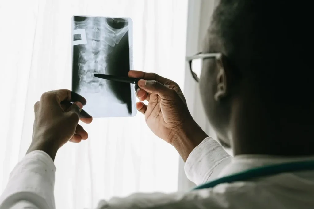 Spinal Tumor Symptoms image