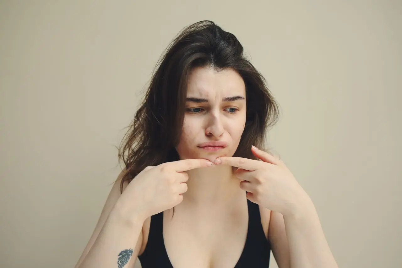 Best Foods for Hormonal Acne Image